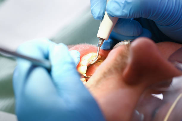 Best Emergency Treatment for Jaw Pain or Injury in Villanova, PA